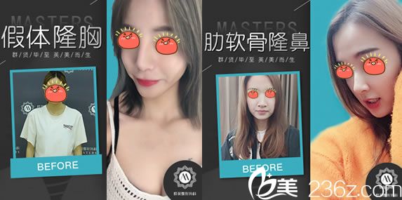 網(wǎng)紅選擇<i data-id='09c960b9-3023-4b19-9b43-adf68bfe9d45' style='display:none;'></i>做隆胸隆鼻 網(wǎng)紅選擇<i data-id='09c960b9-3023-4b19-9b43-adf68bfe9d45' style='display:none;'></i>做隆胸隆鼻