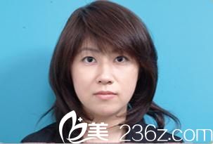 去日本輪廓整形找哪個(gè)醫(yī)生好?在白壁征夫那里做的面部拉皮手術(shù)讓我重返十八歲