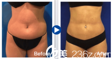 中國(guó)臺(tái)灣京媛體型雕塑案例 中國(guó)臺(tái)灣京媛體型雕塑案例