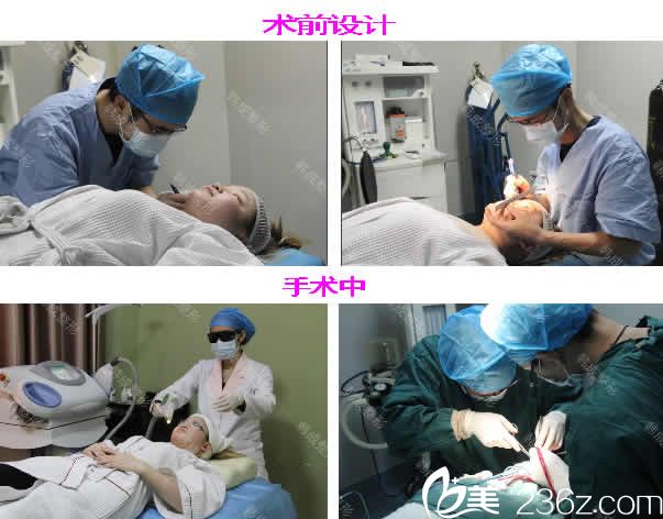 南寧韓成整形醫(yī)生給我做眼鼻部術(shù)前設(shè)計(jì)和手術(shù)中