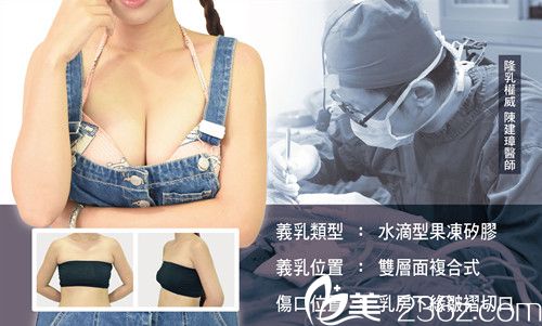 中國臺(tái)灣陳建璋醫(yī)師隆胸案例 中國臺(tái)灣陳建璋醫(yī)師隆胸案例