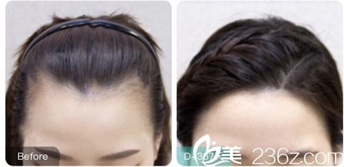  韓國毛理醫(yī)院真實(shí)案例