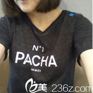 在紹興一美做隆胸手術(shù)前 在紹興一美做隆胸手術(shù)前