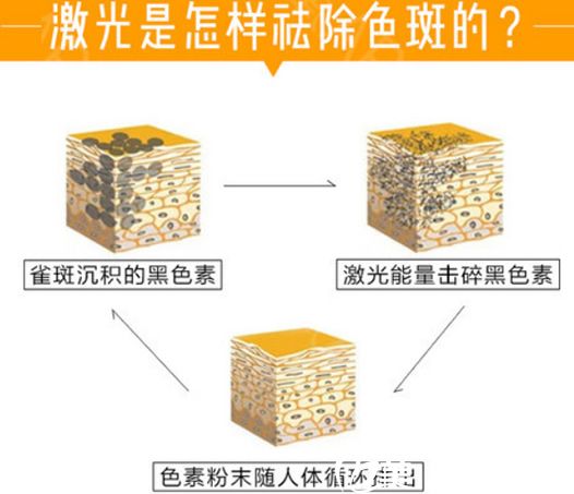 義烏連天美激光祛斑需要多少錢(qián)?醫(yī)院更新2019整形價(jià)格表和張健祛斑美膚案例效果圖