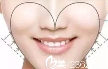 易韓安和美容整形醫(yī)院會告訴你什么是心形臉 易韓安和美容整形醫(yī)院會告訴你什么是心形臉