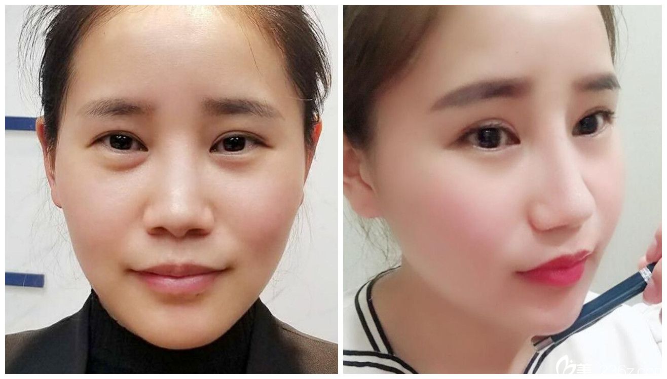 屬于合肥臺(tái)美麗格整形6D<span style=