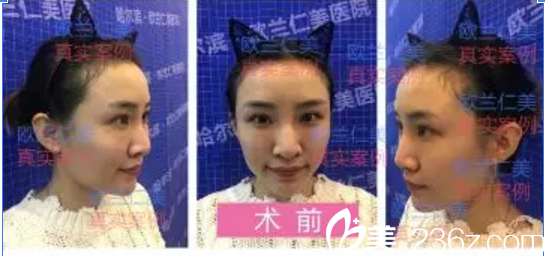 術(shù)前的照片