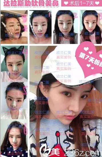 術(shù)后1--7天的恢復(fù)過(guò)程