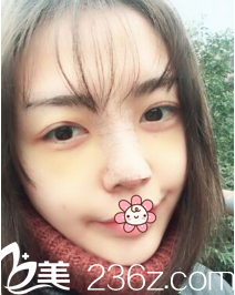 尹賢哲院長給我手術(shù)后第三天 尹賢哲院長給我手術(shù)后第三天