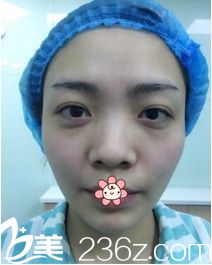 術(shù)前 術(shù)前