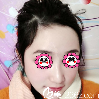 北京聯(lián)合麗格顴骨顴弓整形<span style=