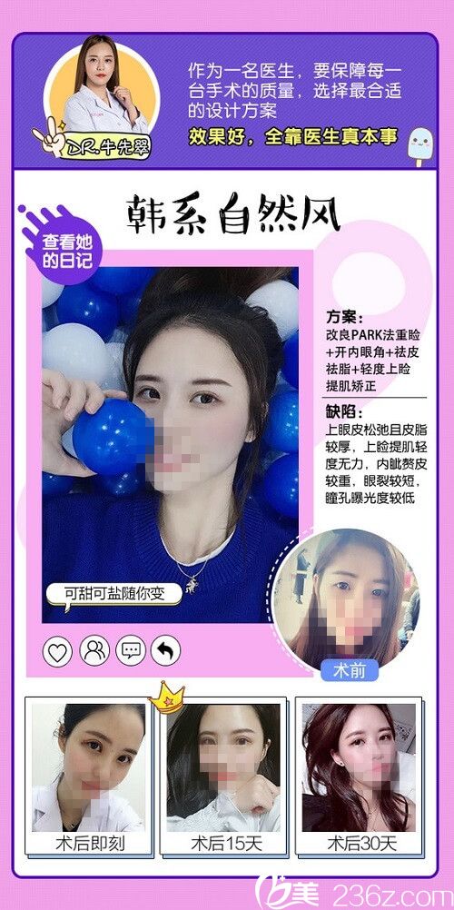 贛州華美整形醫(yī)院眼綜合開年優(yōu)惠，雙眼皮+開眼角手術，下單就送價值200元玻尿酸