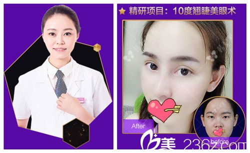 看廣州韓妃整形李光琴割雙眼皮好嗎 看廣州韓妃整形李光琴割雙眼皮好嗎