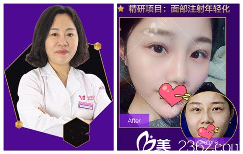 看廣州韓妃楊青青做微整形怎么樣 看廣州韓妃楊青青做微整形怎么樣