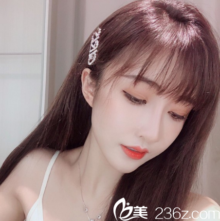 廣州美萊張毓做脂肪填充怎么樣