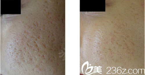 日本Ta’s Clinic新宿本多剛大相關(guān)案例 日本Ta’s Clinic新宿本多剛大相關(guān)案例