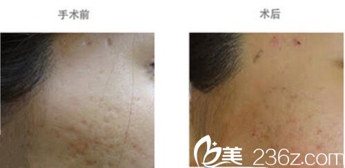 日本Ta’s Clinic新宿本多剛大相關(guān)案例 日本Ta’s Clinic新宿本多剛大相關(guān)案例