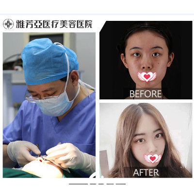 石家莊雅芳亞2019開運整形優(yōu)惠季 享雙眼皮和紋眉880元冰點價