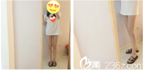 廣州韓妃于洪瑞做吸脂怎么樣 廣州韓妃于洪瑞做吸脂怎么樣