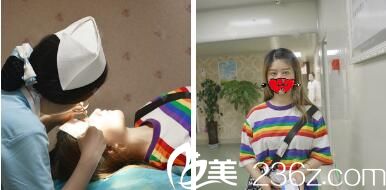 術(shù)后7天到院拆線復(fù)查 術(shù)后7天到院拆線復(fù)查