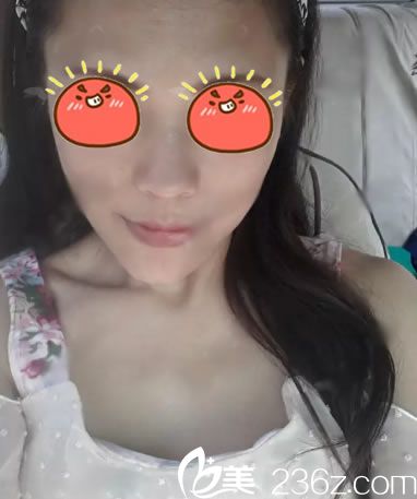 在<!--<i data=20240703-sp></i>-->醫(yī)院做隆胸前 在<!--<i data=20240703-sp></i>-->醫(yī)院做隆胸前