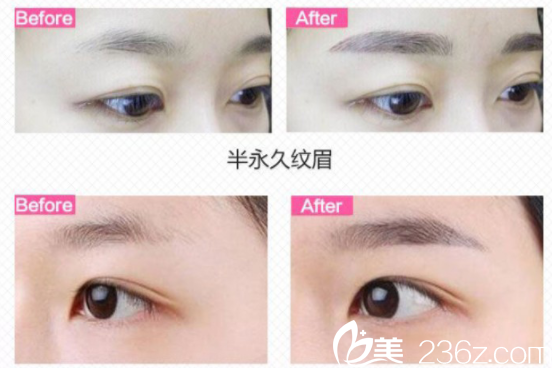 常德伊麗莎白韓式半真人案例 常德伊麗莎白韓式半真人案例