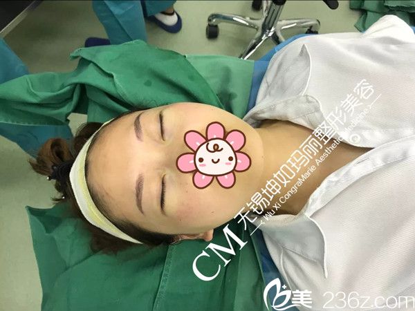 剛做完無痕祛眼袋術(shù)后即刻效果 剛做完無痕祛眼袋術(shù)后即刻效果