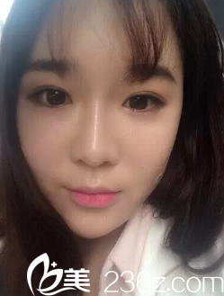 術(shù)后第3天的我