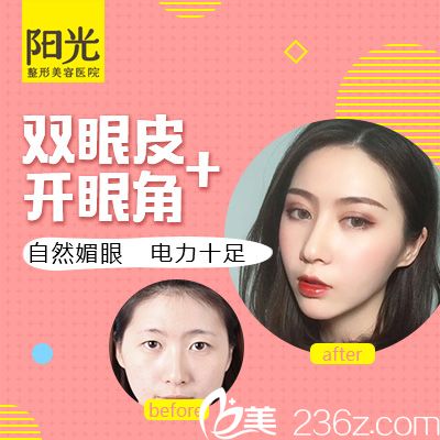 深圳陽光整形醫(yī)院2019新年大促全線項目8.5折 雙眼皮880元,隆鼻2880元,超皮秒祛斑1680元