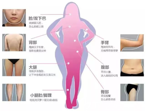 貴陽(yáng)美貝爾SX導(dǎo)航吸脂術(shù)