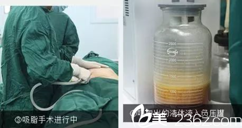 貴陽(yáng)美貝爾吸脂中 貴陽(yáng)美貝爾吸脂中