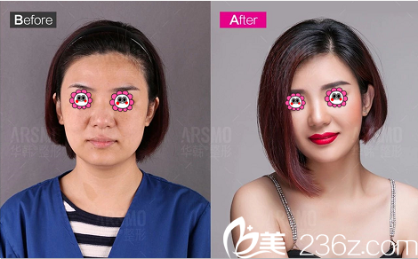 北京華韓虞守輝美膚案例