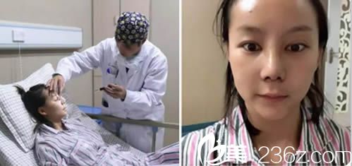 做完鼻子術(shù)后第5天察鵬飛醫(yī)生對我進行了復(fù)診 做完鼻子術(shù)后第5天察鵬飛醫(yī)生對我進行了復(fù)診