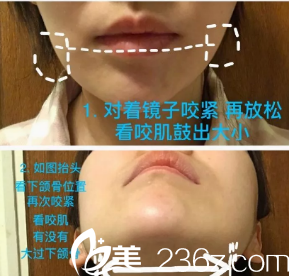 判斷自己是否是咬肌大的示意圖