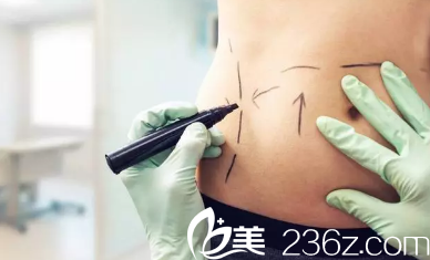 吸脂市面價(jià)格