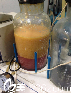 10斤抽出來(lái)的脂肪裝滿容器