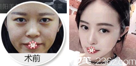 貴陽美萊線雕技術(shù)怎么樣？