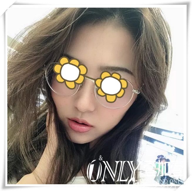 這是合肥壹加壹整形楊義給我做臉部熱提拉次效果圖 親們覺得我變化大嗎