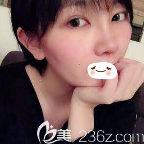 拆線后天效果 拆線后天效果