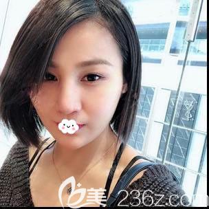 <!--<i data=20240703-sp></i>-->時(shí)光隆鼻效果怎么樣？包濤鼻綜合修復(fù)案例