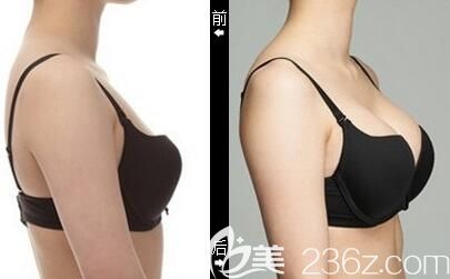 殷運(yùn)成<span style=