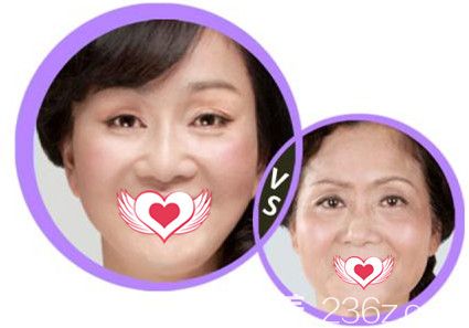 邯鄲維多利亞2019新年整形優(yōu)惠活動火熱進(jìn)行中 全部項(xiàng)目打5折雙眼皮僅580元