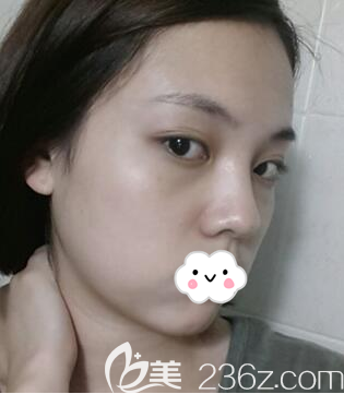 手術(shù)前的我 手術(shù)前的我