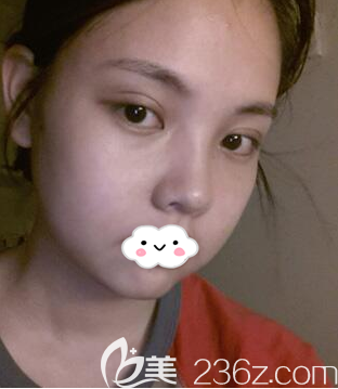 術(shù)后一周 術(shù)后一周