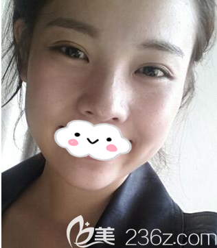 術(shù)后兩個月 術(shù)后兩個月