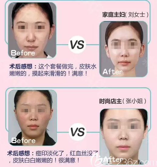 岳陽你美少女針真人案例