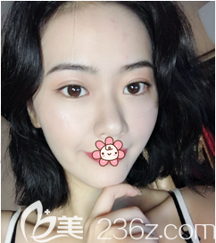 劉彥龍醫(yī)生給我手術(shù)后半個月 劉彥龍醫(yī)生給我手術(shù)后半個月