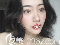 重慶藝星整形做雙眼皮怎么樣 重慶藝星整形做雙眼皮怎么樣