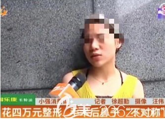 歐女士女士接受記者采訪時(shí)候的鼻部狀況