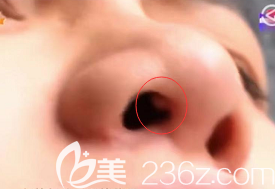 右側(cè)鼻孔有肉球
